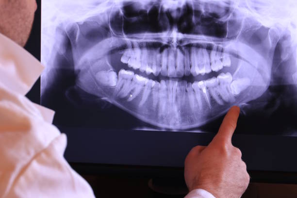 Best Urgent Care for Lost Fillings or Crowns in South Charleston, OH