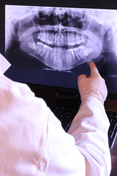 Best Emergency Dental Care for Broken or Chipped Teeth in South Charleston, OH