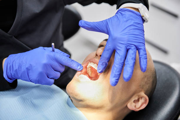 Best Emergency Treatment for Dental Infections or Abscesses in South Charleston, OH