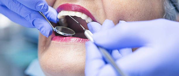 Best Emergency Treatment for Dental Infections or Abscesses in South Charleston, OH